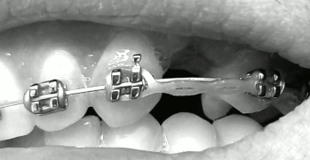 Teeth animation